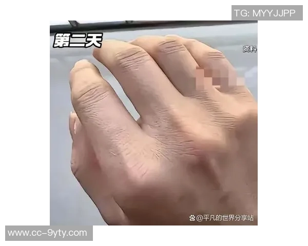 梅尔顿因旧伤复发赛后冰敷右手预计几天后恢复正常状态 梅尔顿因旧伤复发赛后冰敷右手预计几天后恢复正常状态